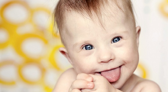 Baby with Down syndrome headshot 580x317
